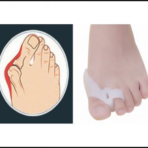 TOE SEPARATOR (Two Holes Bunion Protector)